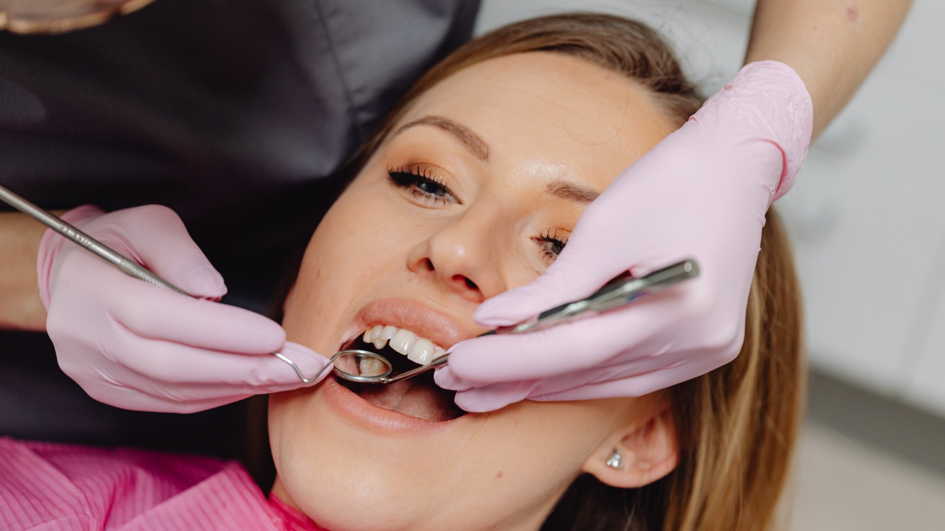 Dental Crowns in Alexandria VA — Dura Dental